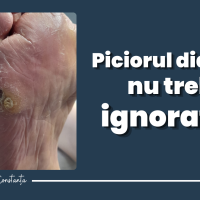 Piciorul diabetic nu trebuie ignorat